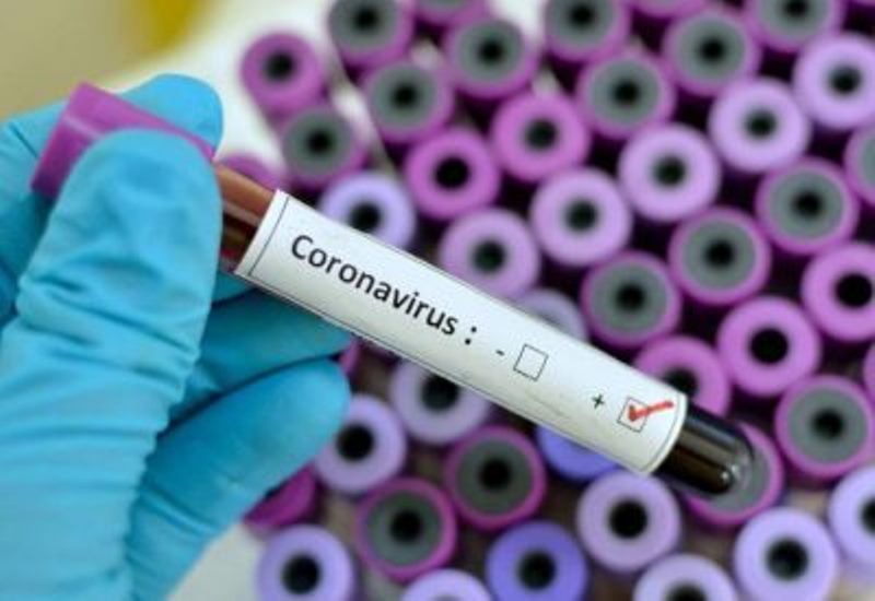 ¿POR QUÉ NO SE PUEDE REVELAR LA IDENTIDAD DE LOS INFECTADOS CON CORONAVIRUS?