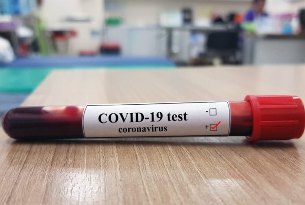 BAHÍA BLANCA: Murió una mujer y son 20 las víctimas de coronavirus en la ciudad vecina