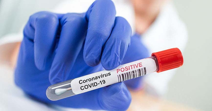 Se confirmaron 7 nuevos casos de Covid-19
