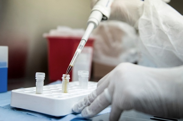 Siguen en aumento los casos de Coronavirus en distritos de la zona