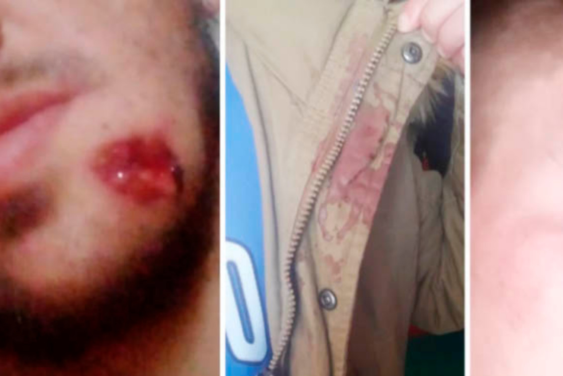 Internos de la cárcel de Saavedra denuncian al personal penitenciario por disparos y golpes