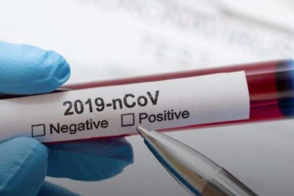 ¿Cómo avanza el coronavirus en distritos de la región?